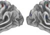 Scientists identify mind-body nexus in human brain