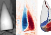 Magnetic fossils may reveal ancient creature’s internal ‘GPS system’