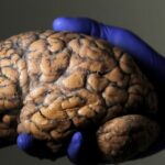 Scientists unveil first draft of atlas of the developing brain