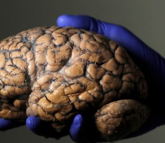 Scientists unveil first draft of atlas of the developing brain