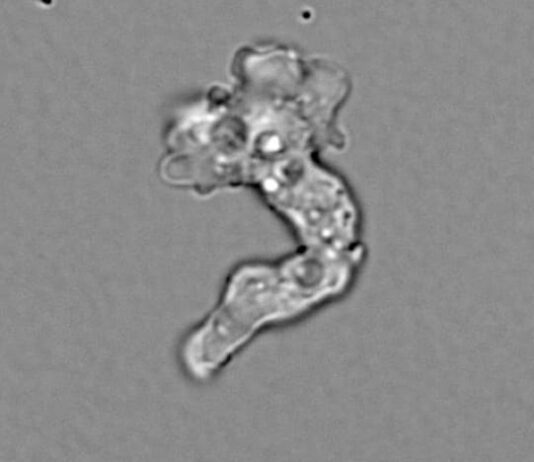 Tenacious hot springs amoeba sets heat-tolerance record